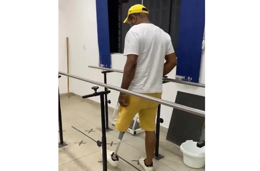 SES-TO realiza medições e entrega de próteses ortopédicas para pacientes do Serviço Especializado em Reabilitação em Araguaína