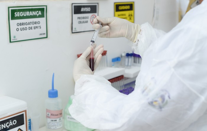 Saúde de Palmas contrata técnicos em laboratório e análises clínicas