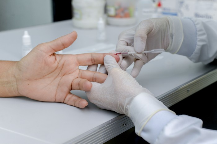 Semus reforça prevenção e controle das hepatites virais no Julho Amarelo