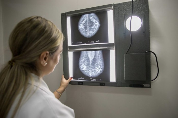 Cancelado debate sobre a importância do diagnóstico precoce de casos de câncer