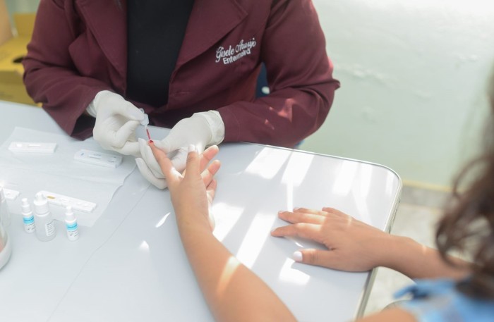 Saúde de Palmas informa quem deve tomar os medicamentos antirretrovirais PrEP e PEP